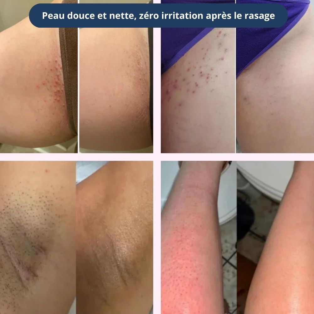 Veloura™ Rasage doux et soyeux, zéro irritation