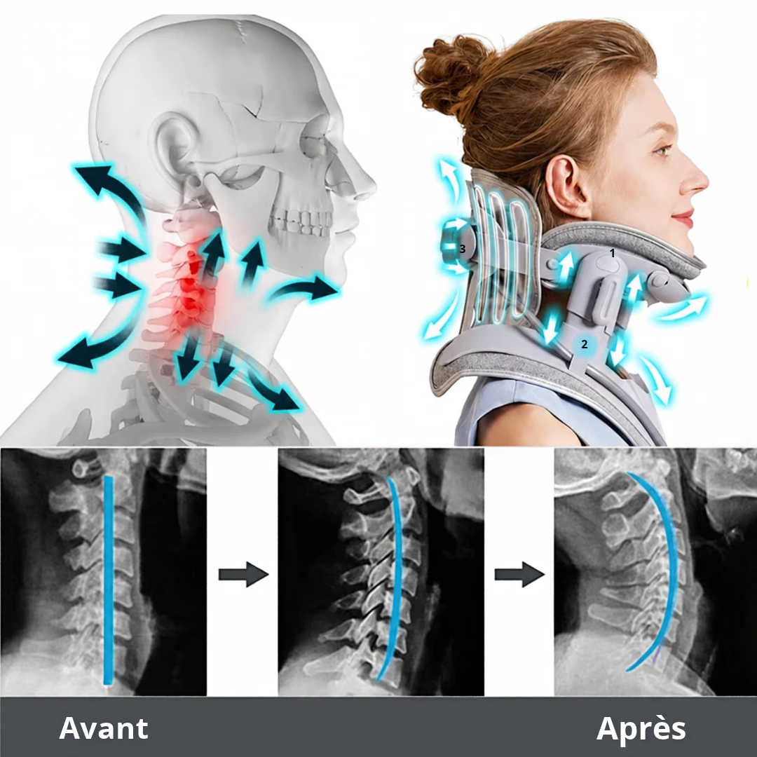 NeckZen™ — L'Appareil Anti-Douleurs Cervicales